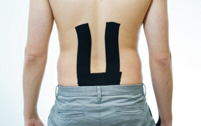 Kineso taping for lower back pain